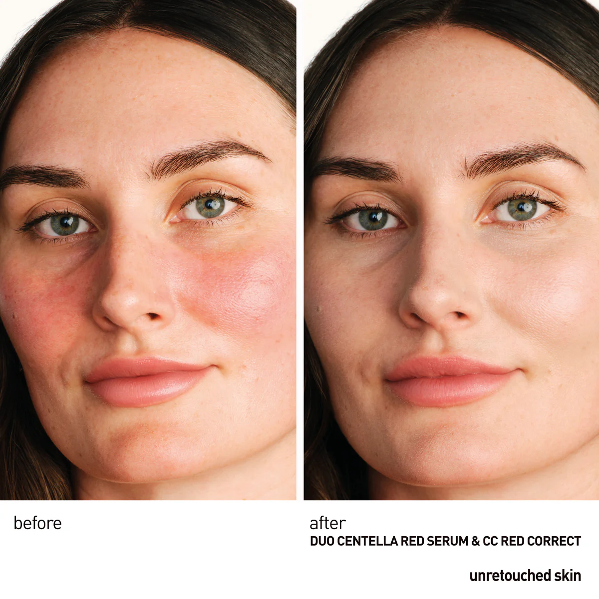 Centella Red Serum Mini (10ml) - Image 4