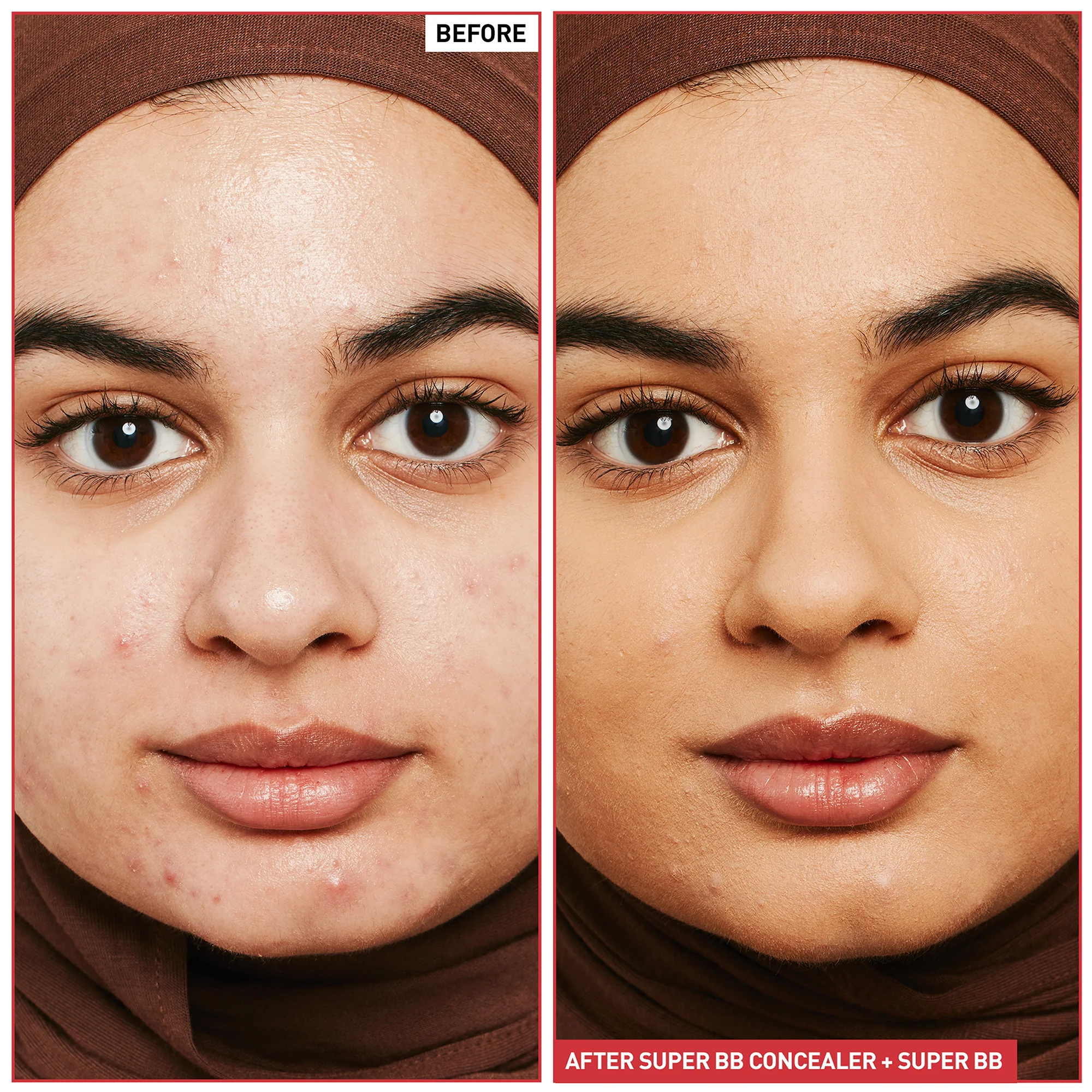 Super BB Concealer (10ml) - 5 Options - Image 9